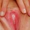 Erections in Women The Clitoris, Its Function