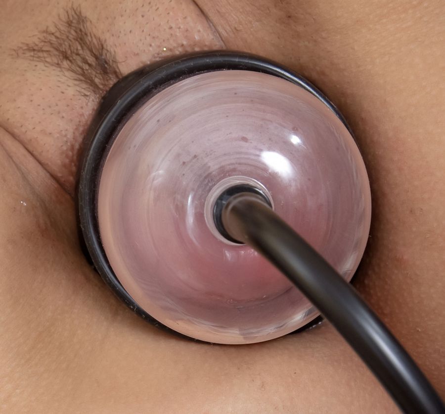 Close up of a vacuum dome placed over female genitals for vacuum suction.